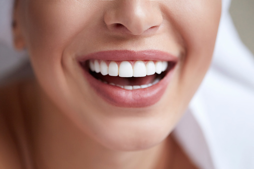 Lady smiling with bright white teeth.