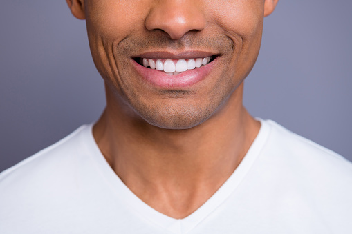 close up of patient's nice smile after tooth reshaping
