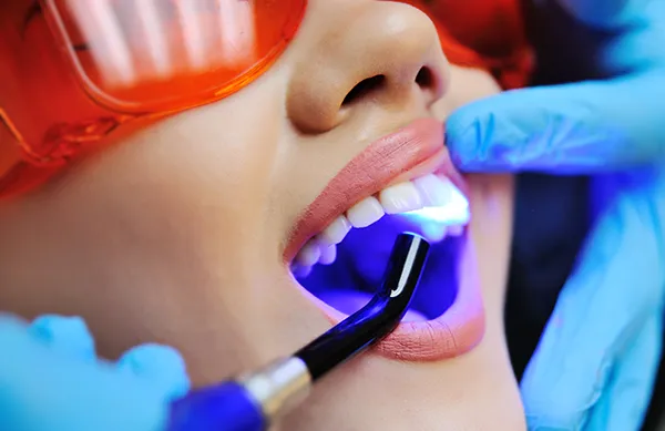 Close up of a dental assistant applying a UV light to a female patient's newly sealed teeth at Singing River Dentistry in Tuscumbia, AL